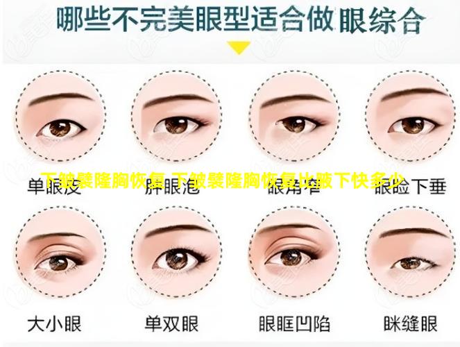 下皱襞隆胸恢复 下皱襞隆胸恢复比腋下快多少